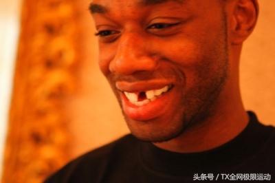 nba球员牙齿掉了怎么办 NBA球员没了牙套会怎么样(4)