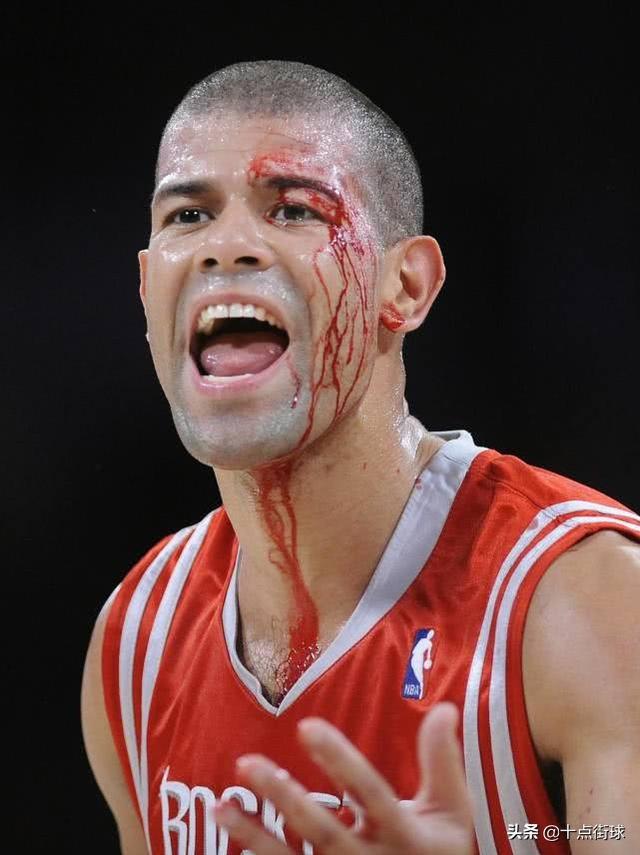 nba球星受伤后 当NBA球员受伤后(1)